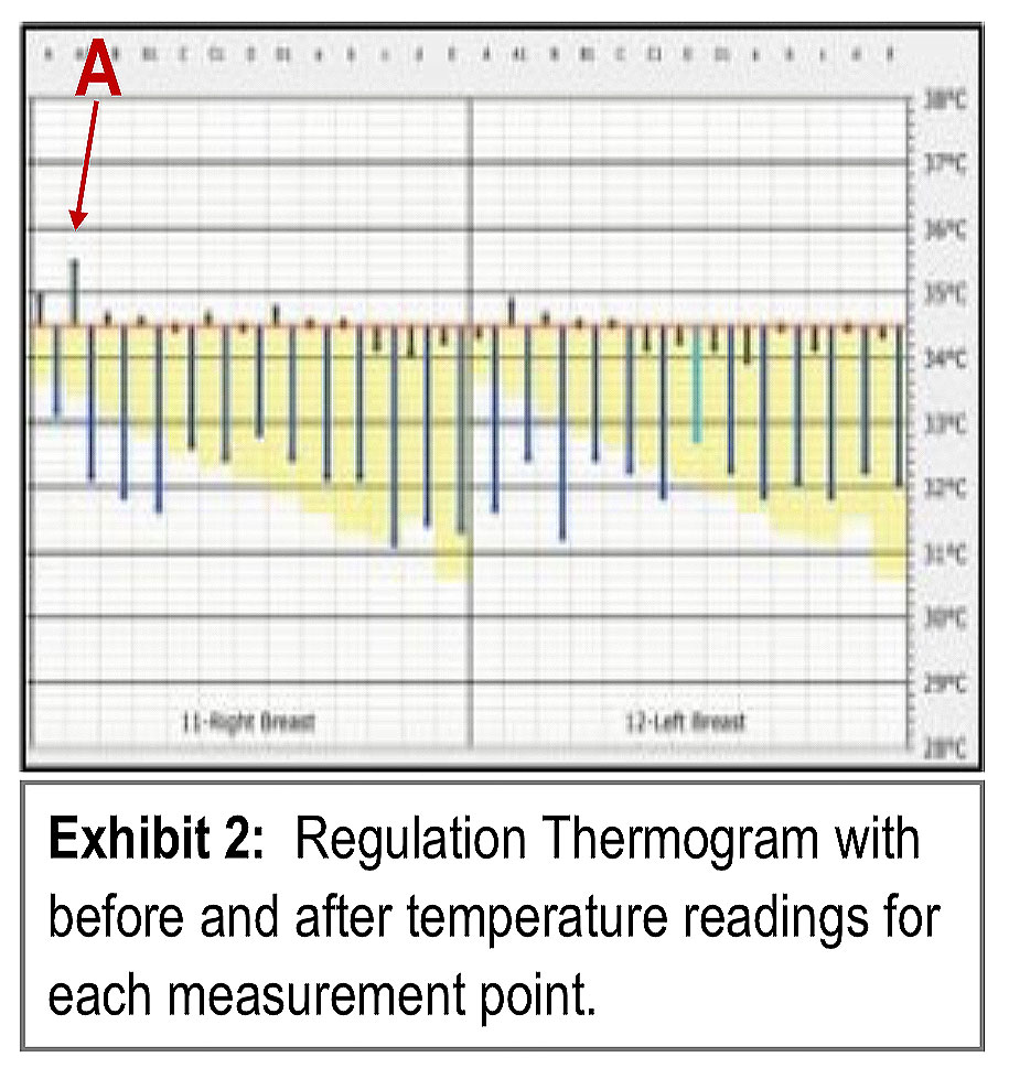 thermometry chart